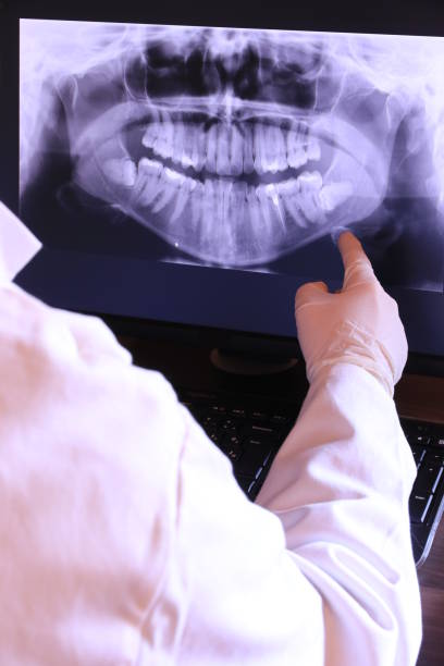 Best Emergency Root Canal Therapy in Olivia, MN
