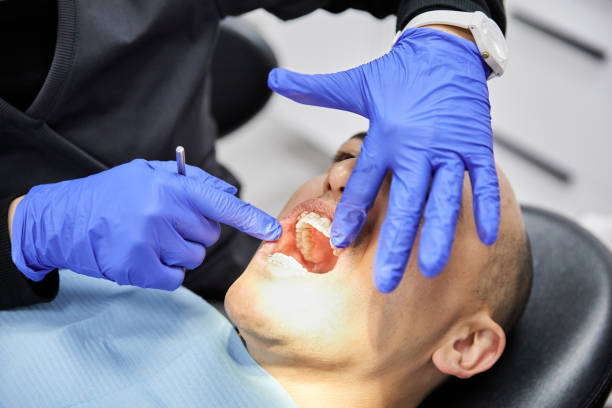 Best Emergency Wisdom Tooth Extraction in Olivia, MN